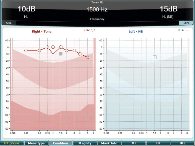on-screen-tone-0abf3d50.png AC40 écran audiométrie tonale